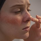 Чувствительная кожа - откройте новые способы ухода и избавьтесь от раздражения! Чувствительная кожа - откройте новые способы ухода и избавьтесь от раздражения!
