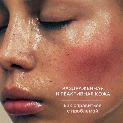 Идеальная гелевая маска против раздражения и зуда кожи лица - комфорт и свежесть уже сегодня! Идеальная гелевая маска против раздражения и зуда кожи лица - комфорт и свежесть уже сегодня!