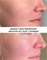 ANANAS-YUDZU RESURFACER SKINCOUTURE | Ананас-Юдзу лактобионовый пилинг