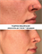 PUMPKIN RESURFACER SKINCOUTURE | Тыквенный пилинг для кожи лица