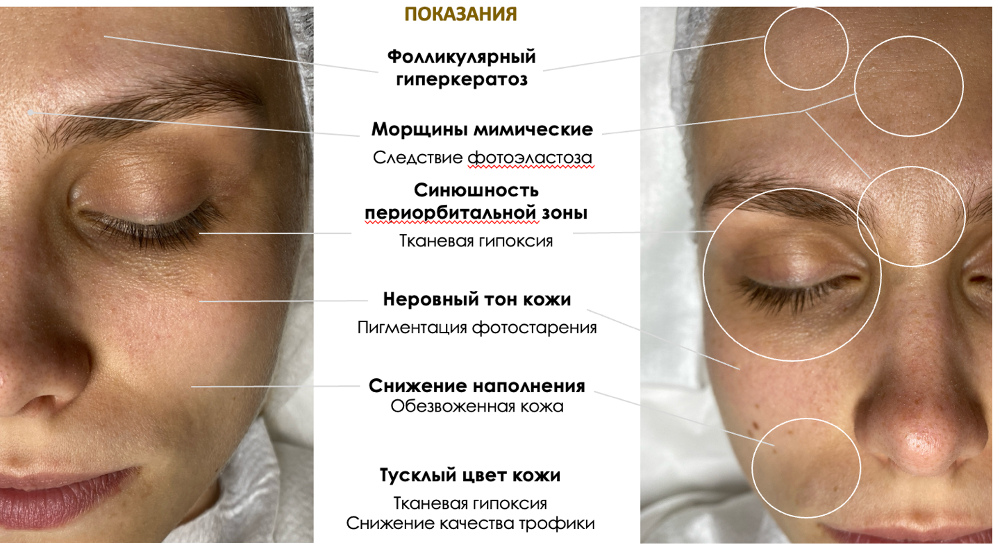 Изображение выглядит как текст, Человеческое лицо, кожа, снимок экранаКонтент, сгенерированный ИИ, может содержать ошибки.