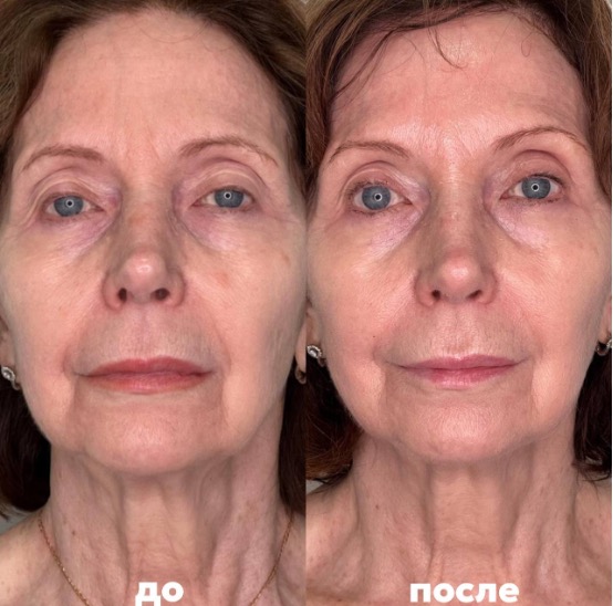 Изображение выглядит как Человеческое лицо, человек, кожа, бровьКонтент, сгенерированный ИИ, может содержать ошибки.