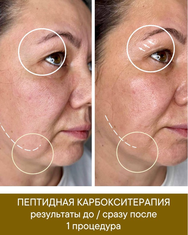 Изображение выглядит как Человеческое лицо, кожа, человек, ЛобКонтент, сгенерированный ИИ, может содержать ошибки.