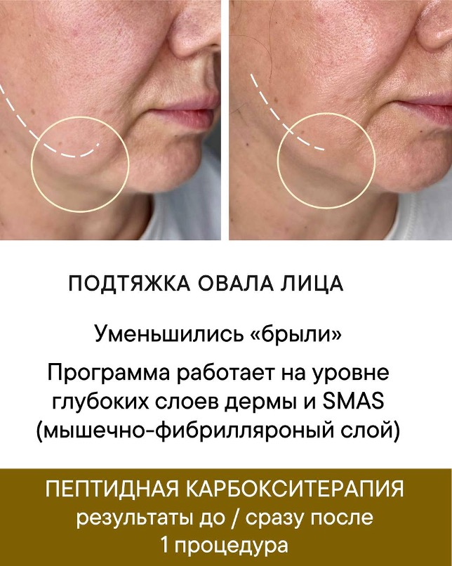 Изображение выглядит как текст, Человеческое лицо, снимок экрана, кожаКонтент, сгенерированный ИИ, может содержать ошибки.